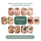 Soraé Veil All-in-One Peptide Serum with Actives 50 mL Korean Skincare, Hydrating, Brightening, Calming, Anti-aging, Niacinamide, Hyaluronic Acid Gentle Daily Serum.